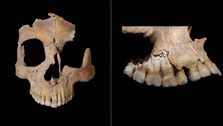  cranio-ritrovato-a-megiddo